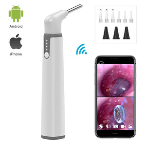 WiFi Ear Otoscope - iSmart Home Gadgets Limited
