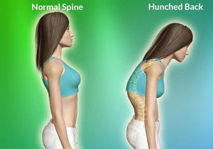 spine corrector pilates | hunchback posture corrector | pilates spine corrector | spine corrector | spine corrector balanced body | spine corrector pilates exercises | balanced body spine corrector | pilates spine corrector exercises | posture corrector in store near me | spine corrector machine