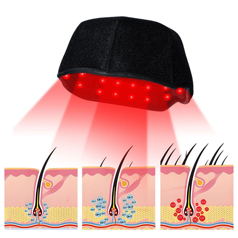 Red light therapy cap DHT hair loss diagram showing red light reducing DHT at follicles and supporting thicker, fuller-looking hair regrowth.